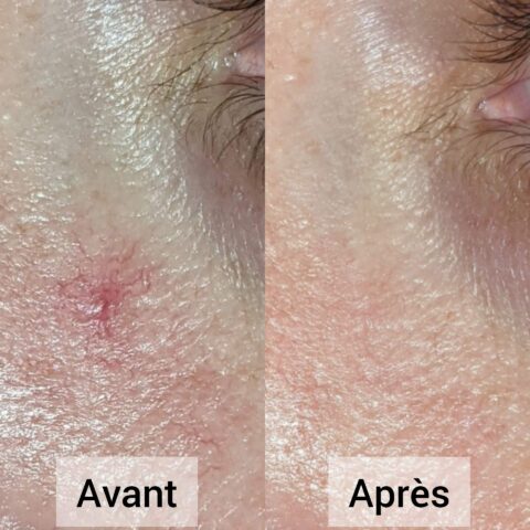 Photo rajeunissement